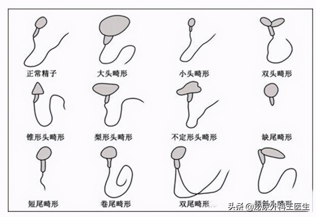 精子品质太差怎么能提高精子品质,人的精子干净程度