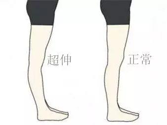 如何14天练出完美小腿,怎么练成小腿细长
