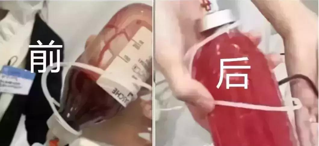 5万一次的血液净化能降血脂吗,健康人做血液净化好处多吗