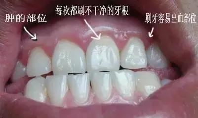 helen鐗欑,Helen榻跨涓績