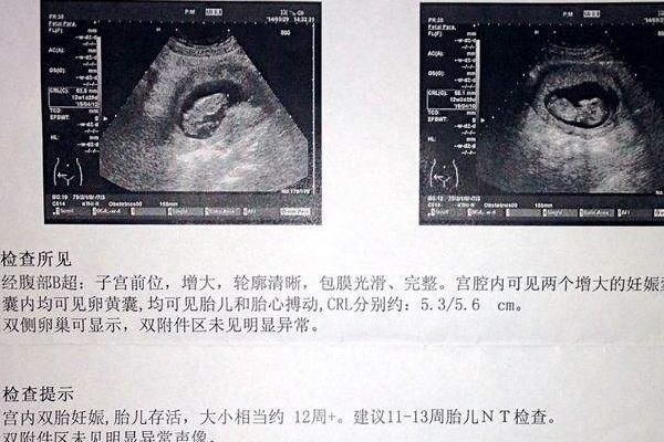 孕妇睡觉时胎儿的姿势,当孕妇睡觉时胎儿在干嘛