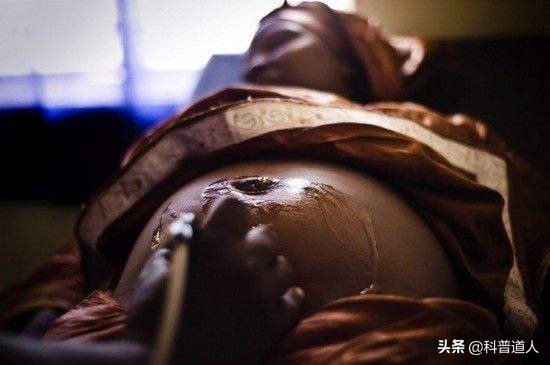 封建欧洲的特殊产物，女性贞节带