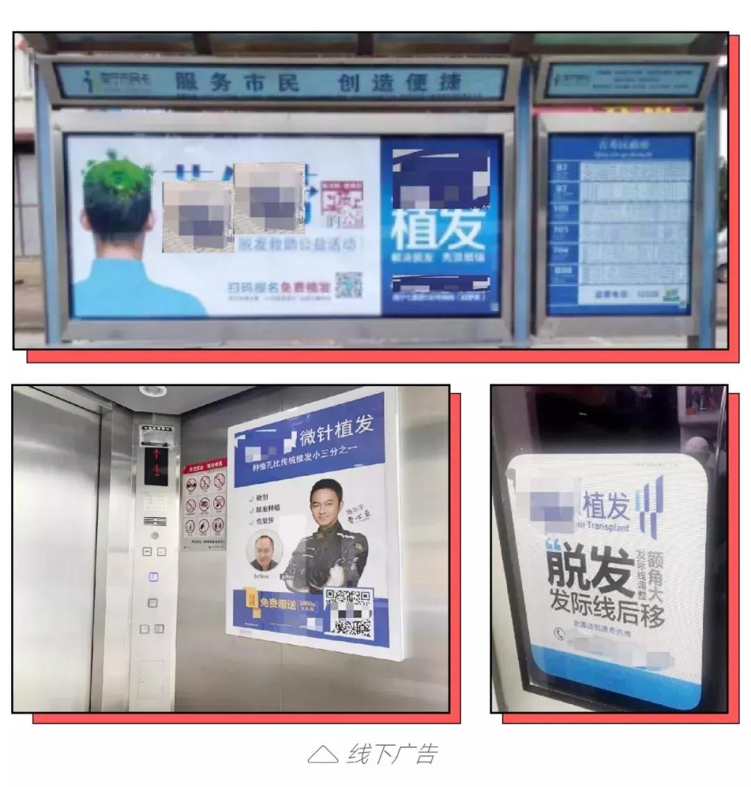 90后秃头开始被资本收割了,90后秃然崛起你们的发际线还好吗