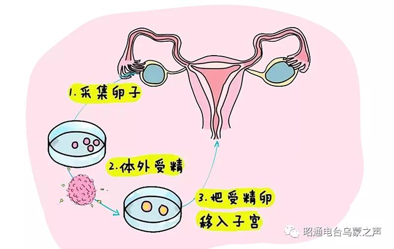 助您好“孕”《祝您健康》昭通仁安医院彭艺医生教你备孕知识
