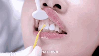 无锡缺牙优惠补贴多少钱,缺牙人士看过来种牙补贴免费领