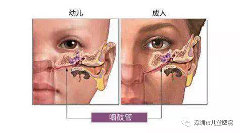 五岁孩子发烧感冒后脸上起小红点,5岁男孩发烧后耳朵里面红肿