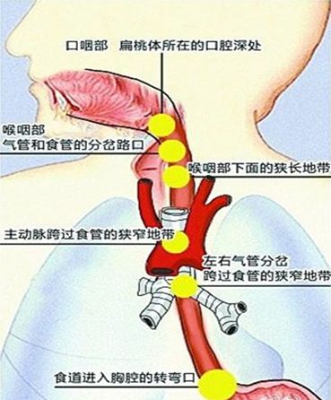 耳鼻喉医学小常识之异物篇,耳鼻喉医生调侃句子
