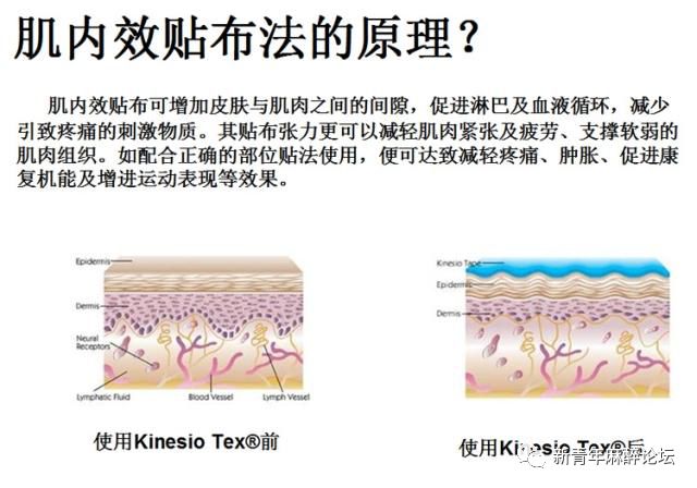 落枕了怎么办最快最有效方法,落枕了怎么办按什么穴位