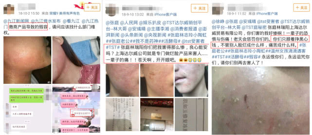 火爆的微商面膜,吸血的微商面膜生意