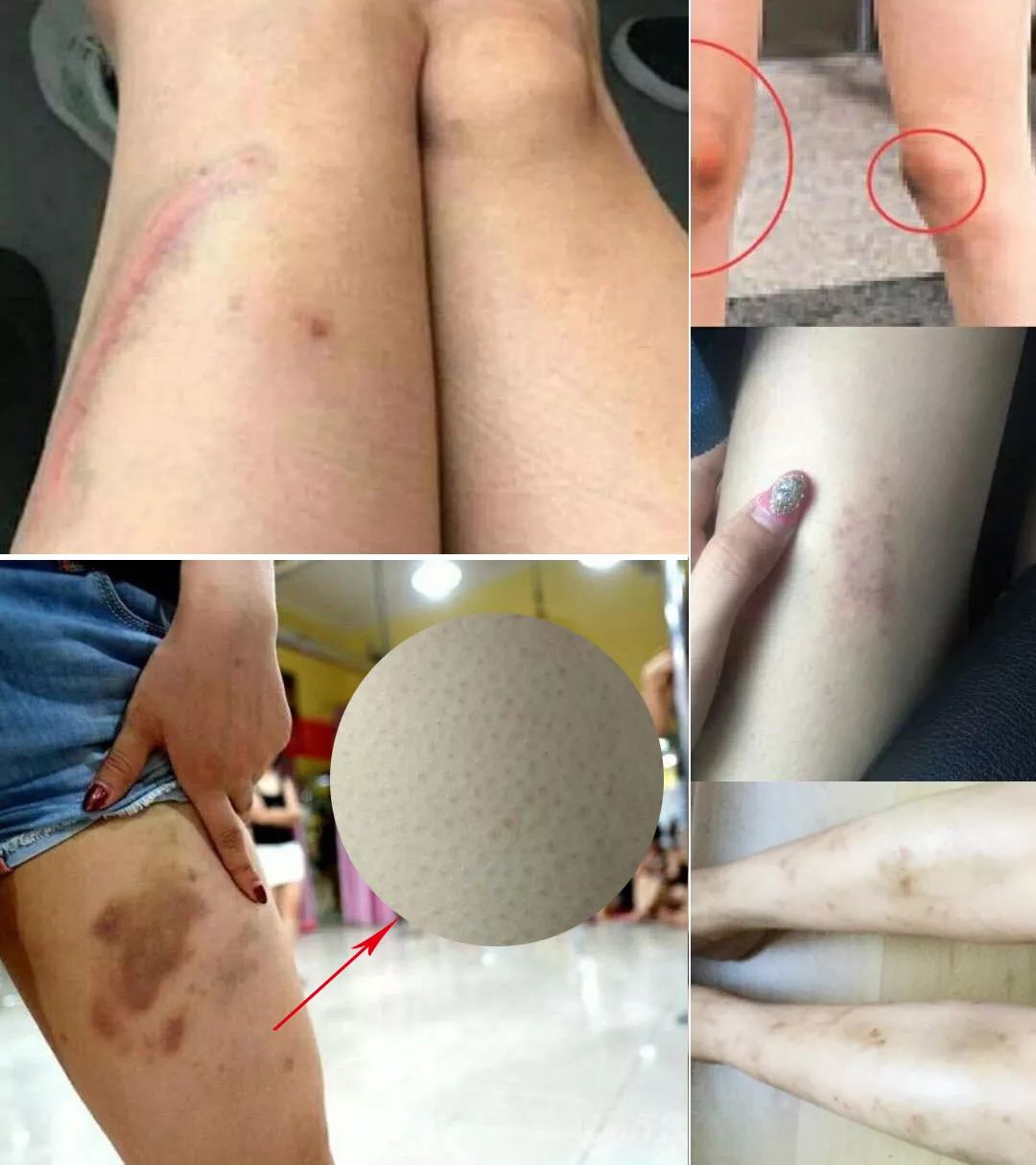 液体*袜丝**是什么鬼？用过的妹子都尖叫！黑腿瑕疵都没了