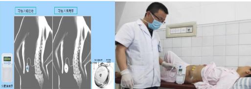 山东疼痛医学研究中心,中国最权威疼痛专科医院