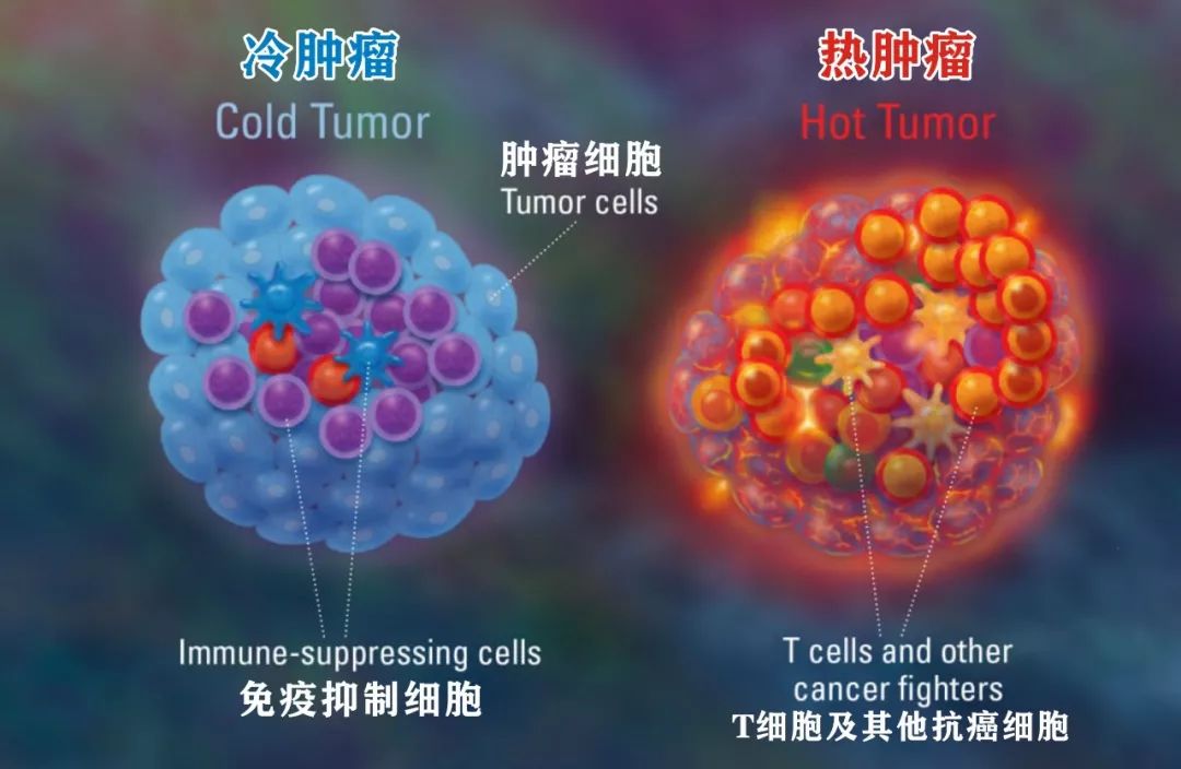 如何把冷癌症变成热癌症,癌症热疗新趋势热死癌症不伤身