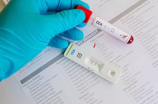 为什么照ct没变化癌胚抗原升高呢,癌症手术后癌胚抗原升高