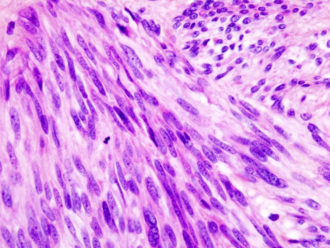 卡死癌细胞的发动机！全球首个广谱KIT*制剂抑**获得FDA批准上市，它杀死癌细胞的方式很特别丨奇点深度