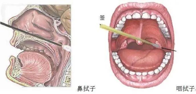 麻麻，核算采样到底痛不痛？