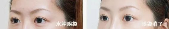 湿气重排不出去吃什么效果好,湿气重不容易瘦怎么办