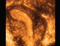 妇幼保健院检查月经,江西省妇幼保健院宫腔镜检查