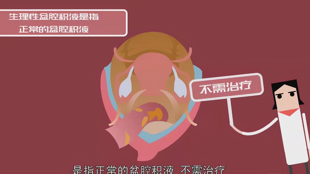 体检查出这4种病，医生表示：基本不用治，不要自己吓自己