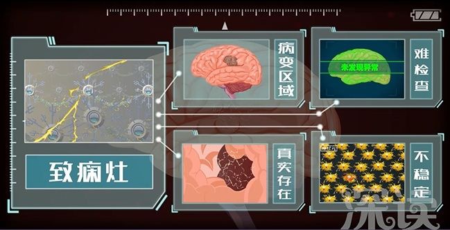 儿童良性癫痫的发病病因,癫痫发病的诱因有哪些