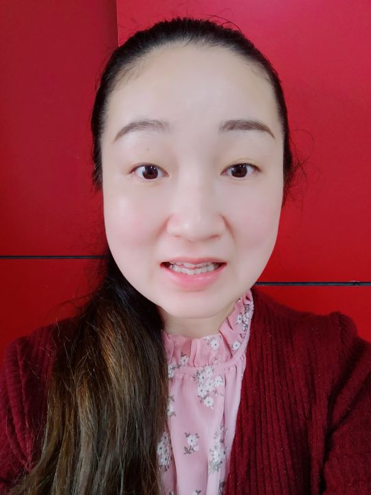35岁小姐姐的牙齿矫正日记（3）
