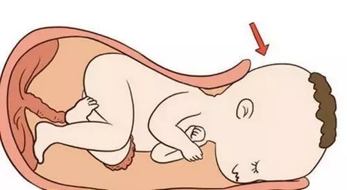 剖腹产的孩子容易感统失调吗,剖腹产的孩子需要做感统训练吗