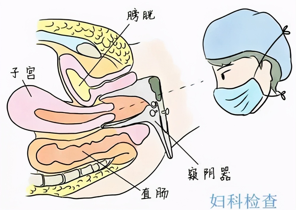定期妇科检查哪些项目,为什么要定期做乳腺检查