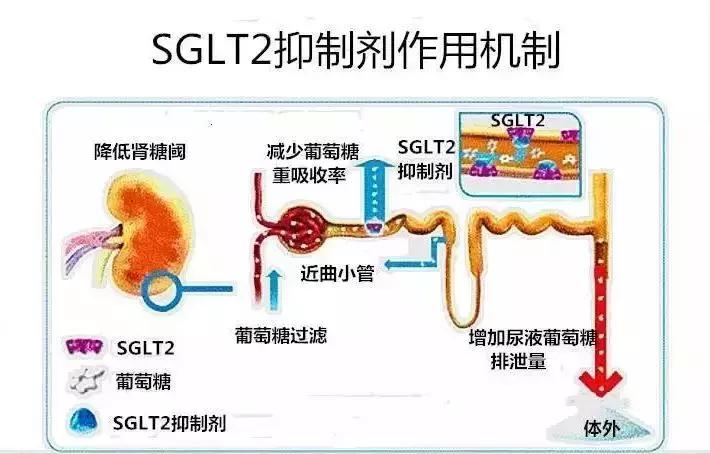 肥胖引起二型糖尿病用吃药吗,糖尿病联合用药方案