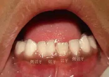 8岁宝宝牙齿长双排牙,1岁婴儿长双牙怎么办