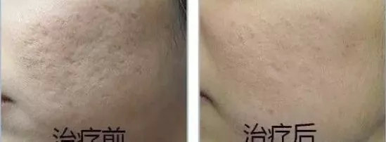 科普桑葚健康知识,科普知识解决生活问题