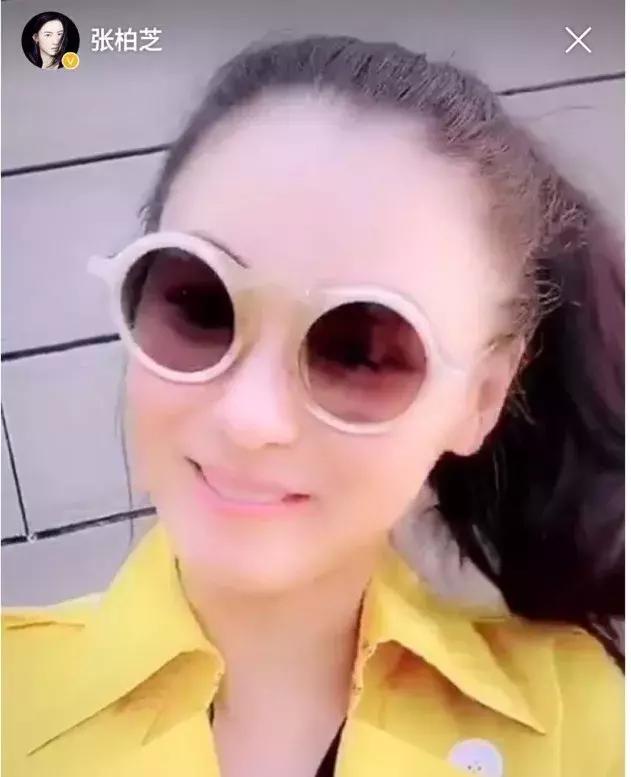 张柏芝生完孩子发胖,张柏芝发际线高多少