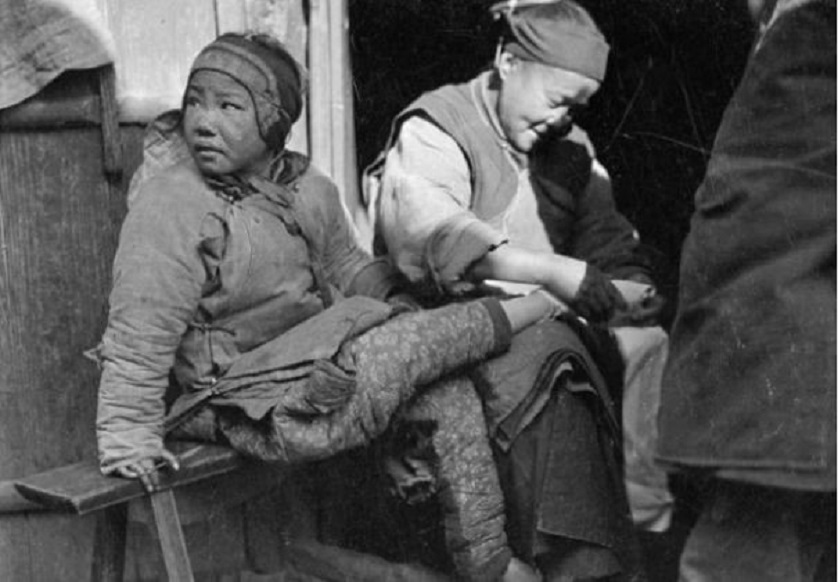 人类进化虱子,虱子与人类共存千万年