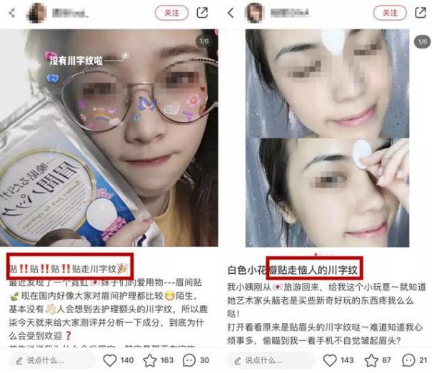 硬刚女皇龙妈也扛不住法令纹，2条沟壑让人心疼，贴一贴就消了