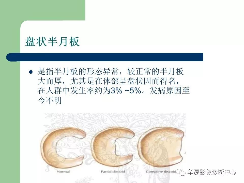 膝关节疼痛有半月板损伤能治好吗,膝盖疼半月板损伤肿胀怎么办