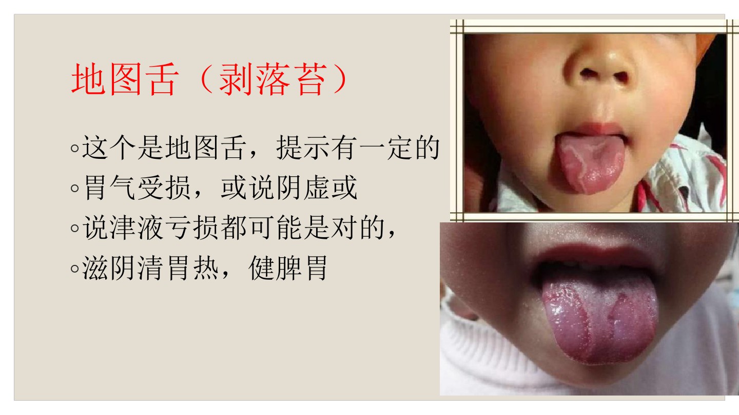 宝宝舌苔怎么辨别热还是寒,如何看宝宝舌苔来区别是否感冒