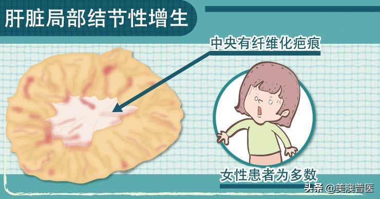 肝脏有阴影怎么进一步检查,肝脏发现癌症怎么办
