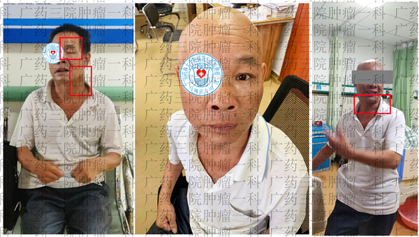 广药三院癌症一科,广药三院癌症综合治疗中心