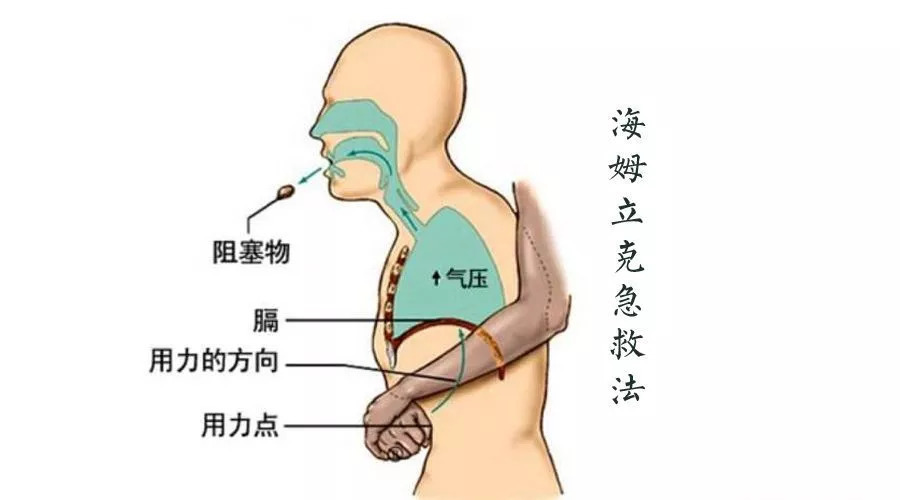 孩子被东西卡到喉咙,小孩子被东西卡喉咙怎么样正常