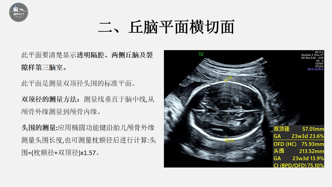 胎儿颅脑超声标准切面图解,胎儿颅脑异常的超声诊断ppt