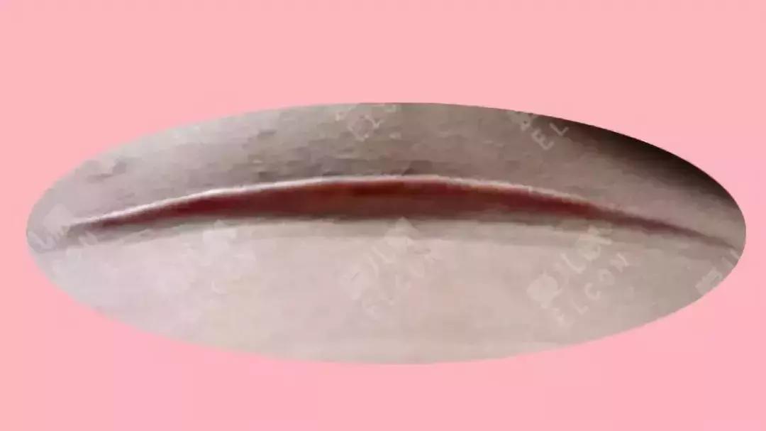 产后刀口又痒又痛的原因居然是这个？