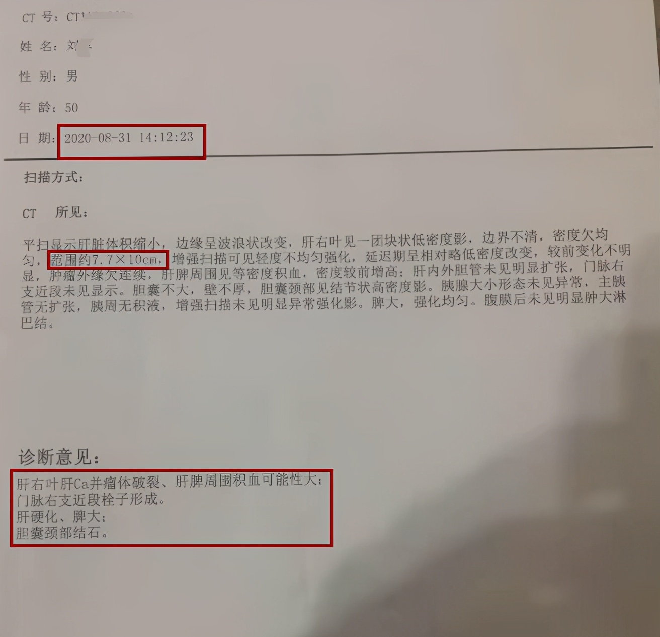 中西结合治疗肝癌效果如何,肝癌癌症破裂出血怎么治疗
