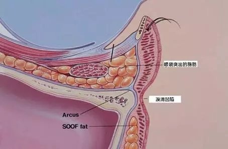 鏈変簡婊ら暅鍐嶅ぇ鐨勭溂琚嬮兘涓嶆槸浜嬪効,鍏眰婊ら暅