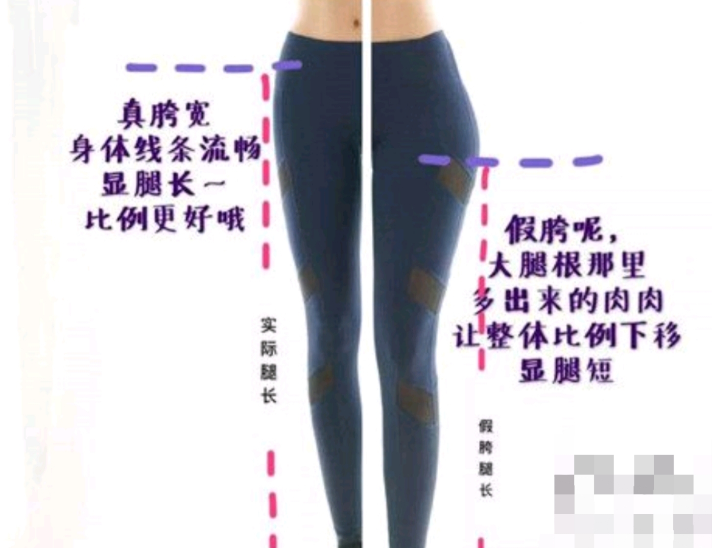 怎么真正有效改善假胯宽,假胯宽矫正的正确方法私教
