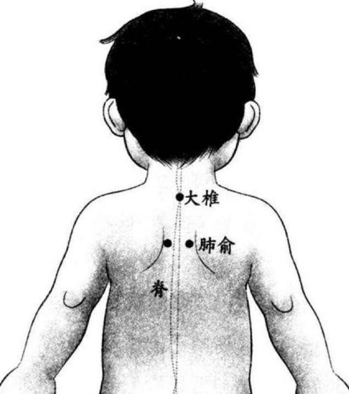 临时感冒解决办法,如果觉得自己要感冒了怎么办