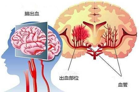 辩论中医行医的问题,中医与西医辩论了100年