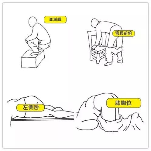 这一项“羞羞”的检查，2分钟查出直肠癌，可惜好多人都不做