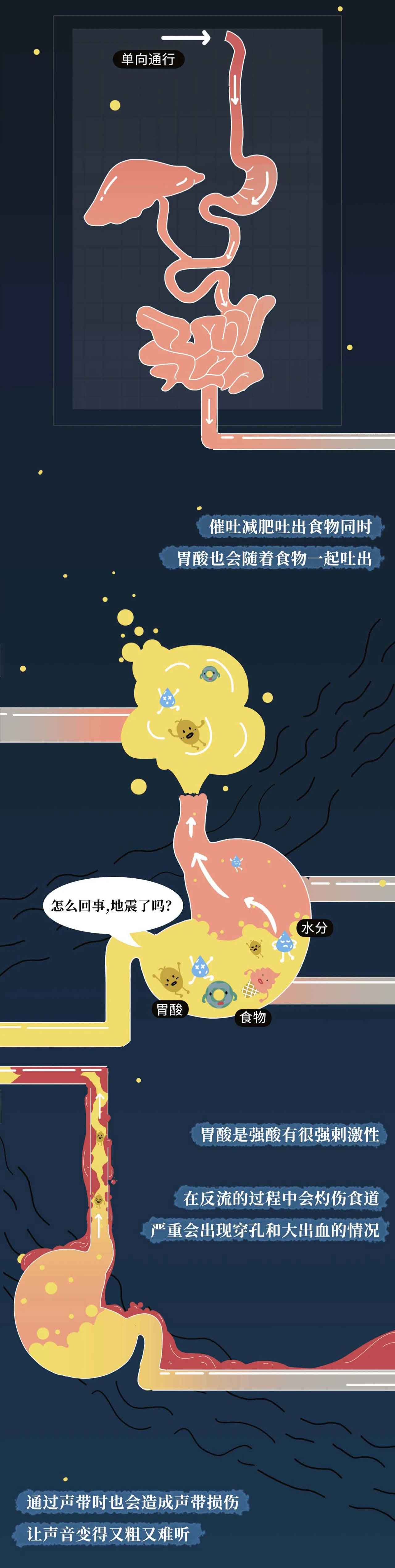 催吐，外挂般的减肥方式？吃的是欲望，吐的是灵魂